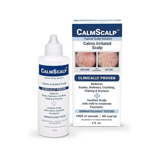 Topical Solution for Symptoms of Mild to Moderate Psoriasis | Irritated Scalp | Hairline Scales | Redness | Dry Scalp | Made in The USA | 4 oz .