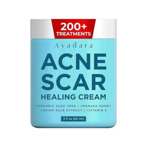 Acne Scar Healing Cream, 2 fl oz, Acne Scar Treatment for Face, Stretch Marks, Body Scars, Acne Scar Removal Cream for Body, Acne Scar Remover for Cuts and Burns, For All Skin Types, 200+ Uses