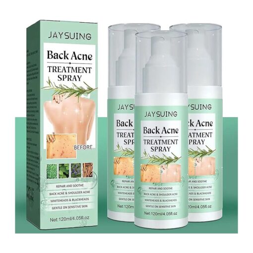 3 Pack Back Acne Treatment, Back Acne Spray, 2 % Salicylic Acid Spray, Body Acne Treatment with Herbal Formula, Body Acne Spray, Tea Tree Oil Spray, Acne Treatment For Teens, Back Acne Solution