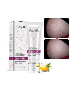 Stretch Mark Removal Cream Repair Scars Stretch Marks Remove Pregnancy Scar Cream