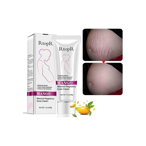 Stretch Mark Removal Cream Repair Scars Stretch Marks Remove Pregnancy Scar Cream