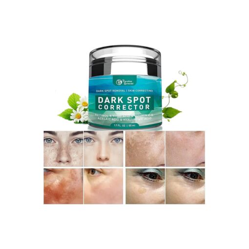 Dark Spot Remover for Face, Hyperpigmentation Treatment, Melasma, Freckle, Sun Spots Removal for All Skin Types Dark Spot Corrector for Men and Women