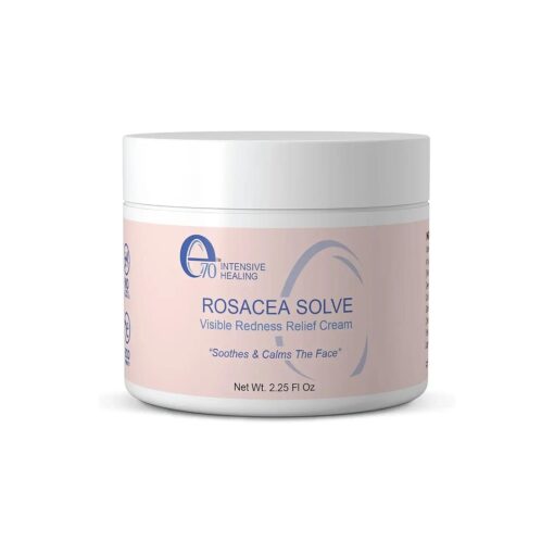 Rosacea Solve - Redness Relief Cream - Face Moisturizer For Rosacea & Acne Prone Skin - Sensitive Skin Care With Organic Ingredients, Almond Oil, Licorice & Chamomile Extracts - No Parabens