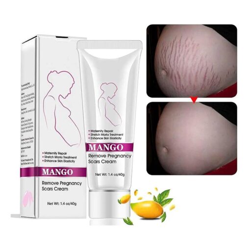 Stretch Mark Cream For Pregnancy Repair Scar Slack Line Abdomen Stretch Marks Cream, Remove Stretch Marks From Pregnancy, Repair Scar Slack Line Abdomen Stretch Marks Postpartum