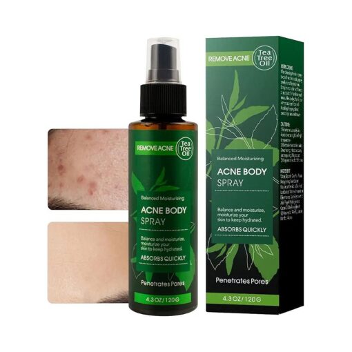 Acne Spray/Treatment, Body/Back/Face/Chest Clear Acne Spray, Skin Care, Contain Natural Organic Tea Tree Oil For Skin To Peace Out Acne Healing Dots, Balance And Moisturizing - 4.3 OZ