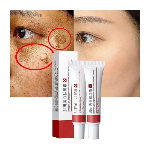 2 Pcs Whitening Freckle Cream, Acne Scar Removal Treatment Cream, Pigmentation Removal Cream for Face, Moisturizing Removes Facial Melasma Dark Spots Wrinkles Blemishes ( whitening freckle cream )